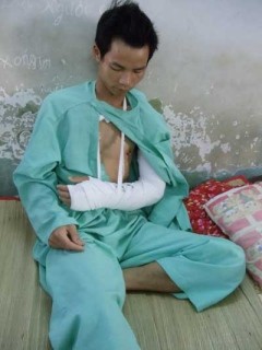 被砍伤手臂的布诺丹