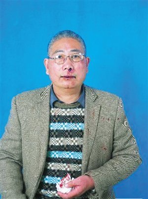 浙江一老人实名举报在政府办公室遭干部暴打