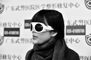 下巴生长不止让阿丽受尽旁人冷眼。
